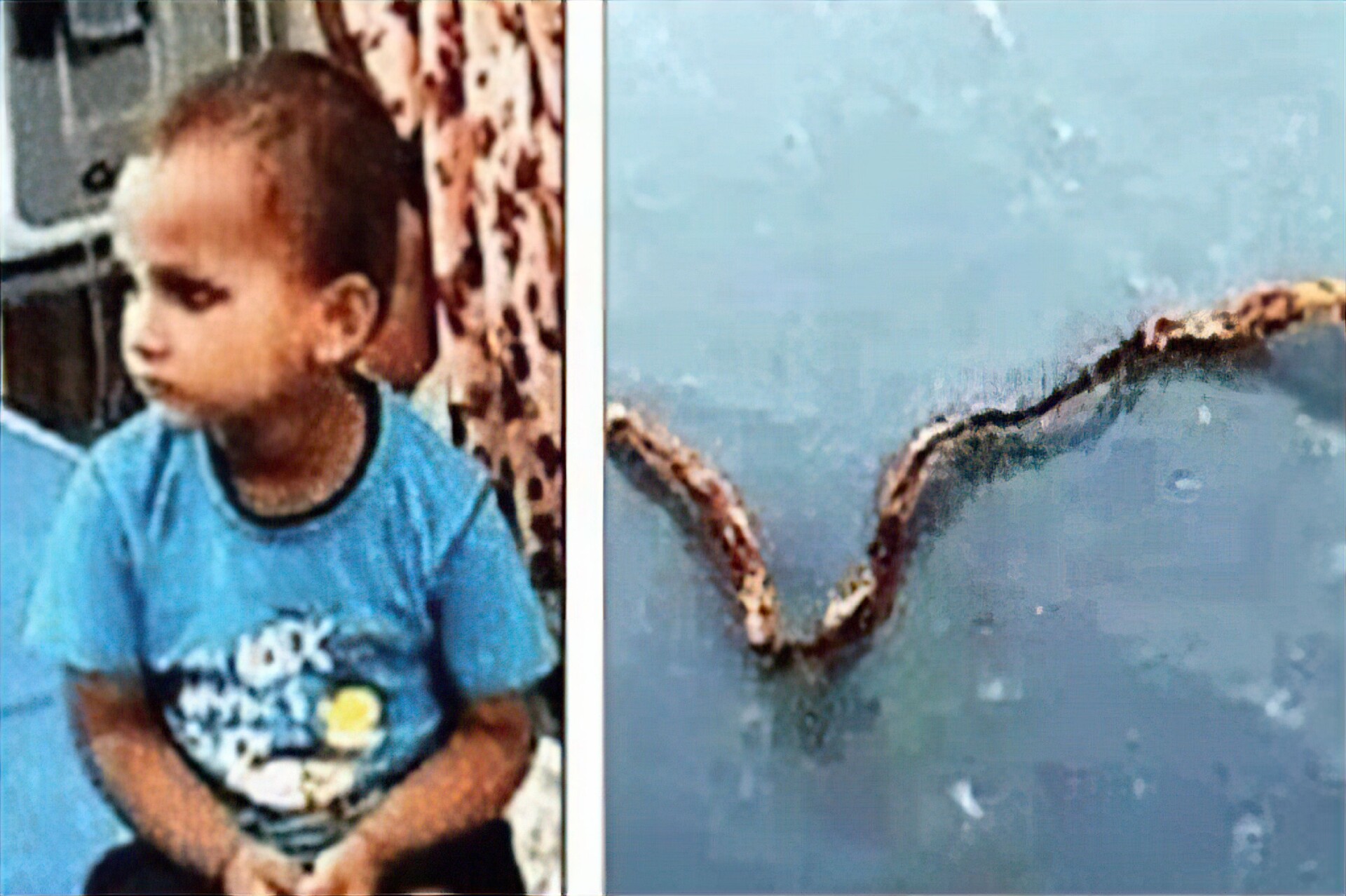 enlarge Three year old children snake kill to teeth